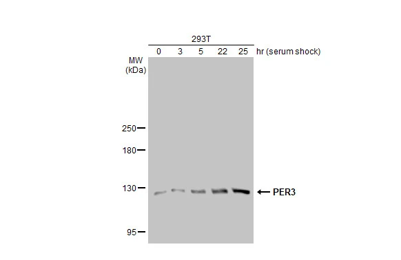 Untreated (-) and treated (+) 293T whole cell extracts (30 microg) were separated by 5% SDS-PAGE, and the membrane was blotted with PER3 antibody [GT1327] (GTX03239) diluted at 1:500. The HRP-conjugated anti-rabbit IgG antibody (GTX213110-01) was used to detect the primary antibody, and the signal was developed with Trident ECL plus-Enhanced.