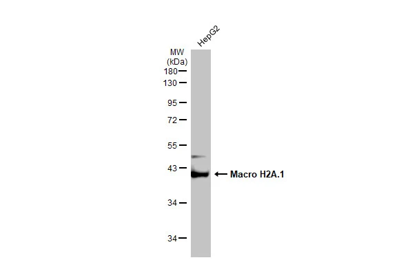 Whole cell extract (30 microg) was separated by 10% SDS-PAGE, and the membrane was blotted with Macro H2A.1 antibody [GT1329] (GTX03241) diluted at 1:5000. The HRP-conjugated anti-rabbit IgG antibody (GTX213110-01) was used to detect the primary antibody.