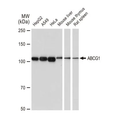 WB analysis of various samples using GTX03242 ABCG1 antibody [GT1330].<br>Dilution : 1:1000<br>Loading : 25&#956;g per lane