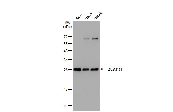 Various whole cell extracts (30 microg) were separated by 12% SDS-PAGE, and the membrane was blotted with BCAP31 antibody [GT1333] (GTX03245) diluted at 1:1000. The HRP-conjugated anti-rabbit IgG antibody (GTX213110-01) was used to detect the primary antibody.