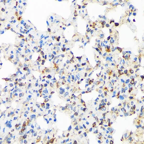 IHC-P analysis of rat lung tissue section using GTX03255 TIRAP antibody [GT1343]. Dilution : 1:100