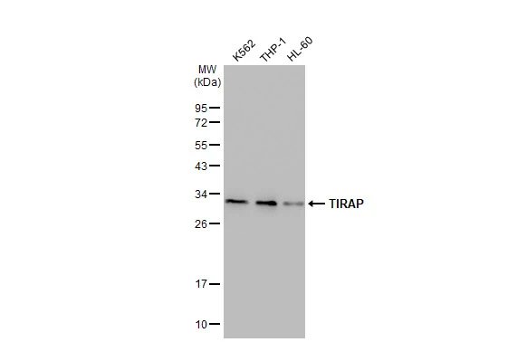 Various whole cell extracts (30 microg) were separated by 12% SDS-PAGE, and the membrane was blotted with TIRAP antibody [GT1343] (GTX03255) diluted at 1:1000. The HRP-conjugated anti-rabbit IgG antibody (GTX213110-01) was used to detect the primary antibody.