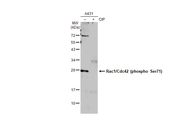 Untreated (-) and treated (+) A431 whole cell extracts (30 microg) were separated by 12% SDS-PAGE, and the membrane was blotted with Rac1/Cdc42 (phospho Ser71) antibody [GT1345] (GTX03257) diluted at 1:500. The HRP-conjugated anti-rabbit IgG antibody (GTX213110-01) was used to detect the primary antibody, and the signal was developed with Trident ECL plus-Enhanced.