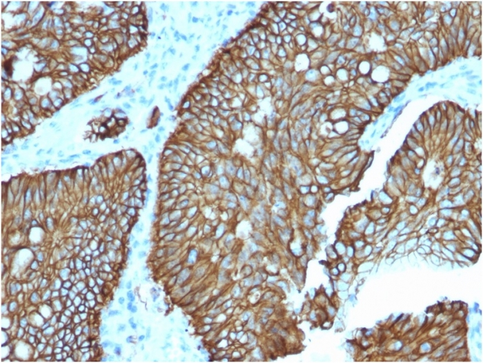 IHC-P analysis of human colon tissue using GTX03259 LI-Cadherin antibody [CDH17/2618].