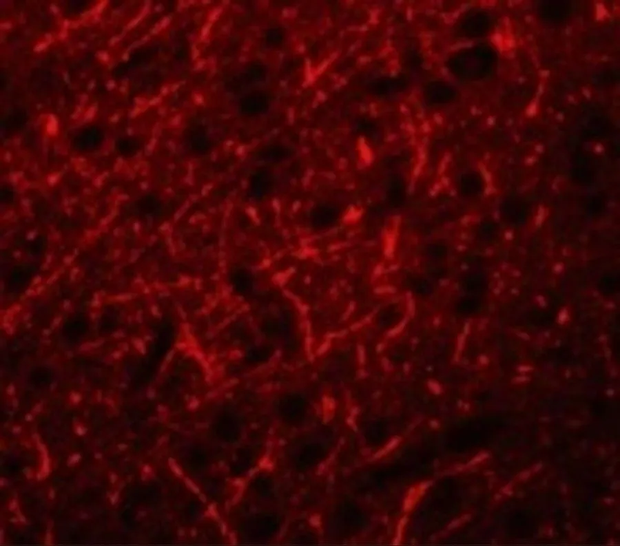 IHC-P analysis of human brain tissue using GTX03275 PRDM16 antibody. Dilution : 20 microg/ml IHC-P analysis of human brain tissue using GTX03275 PRDM16 antibody. Dilution : 20 microg/ml