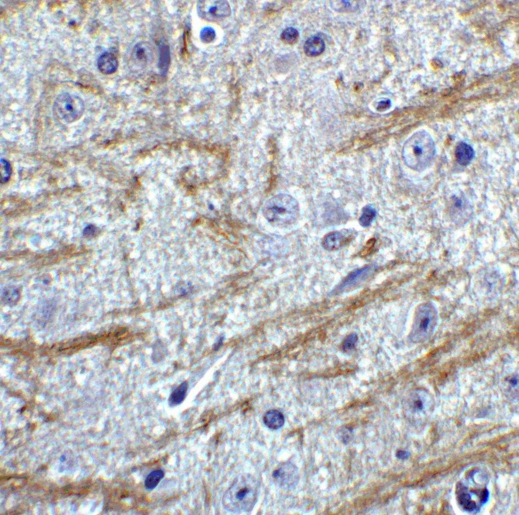 IHC-P analysis of mouse brain tissue using GTX03275 PRDM16 antibody. Dilution : 2 microg/ml