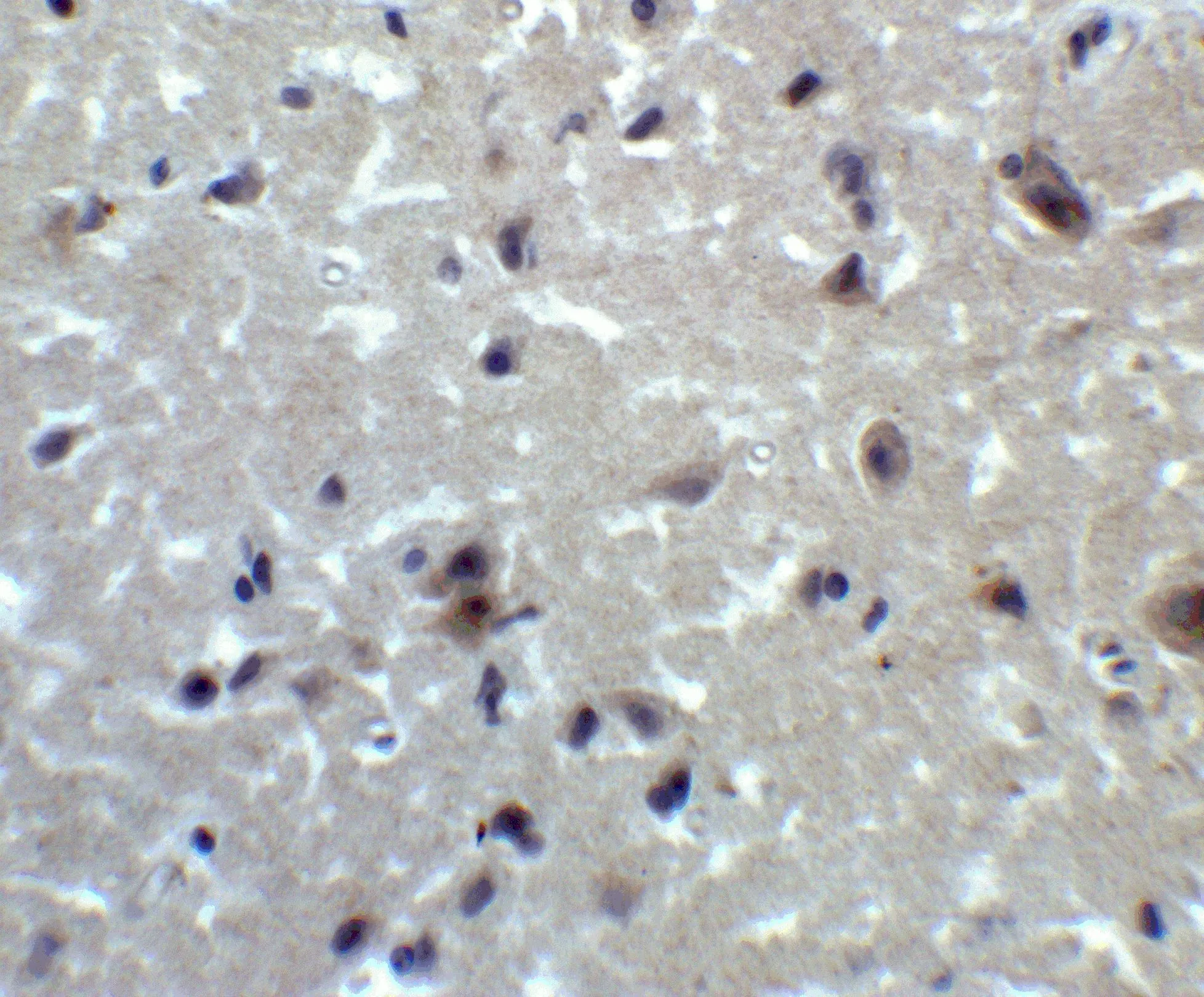 IHC-P analysis of human brain tissue using GTX03275 PRDM16 antibody. Dilution : 2 microg/ml