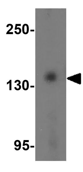 WB analysis of K562 cell lysate using GTX03275 PRDM16 antibody. Dilution : 1 microg/mL.