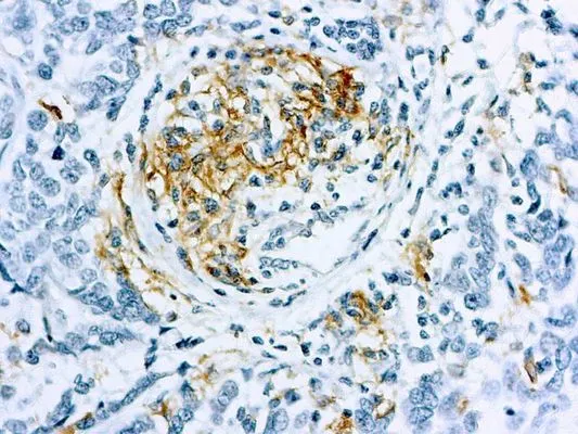 IHC-P analysis of human skin tissue section using GTX03332 Claudin 1 antibody. IHC-P analysis of human skin tissue section using GTX03332 Claudin 1 antibody.