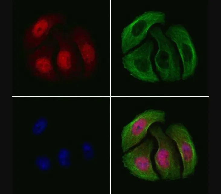 ICC/IF analysis of PFA-fixed HeLa cells (4h of LPS treatment) using GTX03351 Chk2 (phospho Thr68) antibody. Red : Primary antibody Green : Beta tubulin Blue : DAPI Permeabilization : 0.1% Triton X-100 Dilution : 1:200