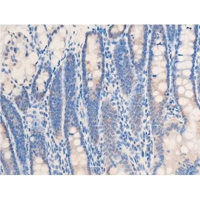IHC-P analysis of rat colon tissue using GTX03351 Chk2 (phospho Thr68) antibody. Antigen retireval : heat mediated antigen retrieval step in citrate buffer was performed. Dilution : 1:100