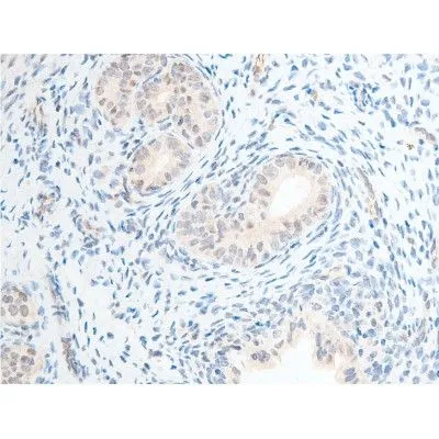 IHC-P analysis of rat uterine tissue using GTX03351 Chk2 (phospho Thr68) antibody. Antigen retireval : heat mediated antigen retrieval step in citrate buffer was performed. Dilution : 1:100