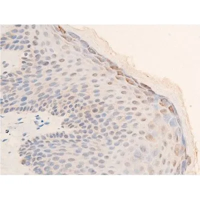 IHC-P analysis of human skin tissue using GTX03351 Chk2 (phospho Thr68) antibody. Antigen retireval : heat mediated antigen retrieval step in citrate buffer was performed. Dilution : 1:100