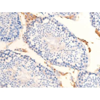 IHC-P analysis of mouse testicular tissue using GTX03351 Chk2 (phospho Thr68) antibody. Antigen retireval : heat mediated antigen retrieval step in citrate buffer was performed. Dilution : 1:100