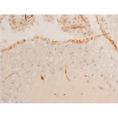 IHC-P analysis of mouse brain tissue using GTX03351 Chk2 (phospho Thr68) antibody. Antigen retireval : heat mediated antigen retrieval step in citrate buffer was performed. Dilution : 1:100