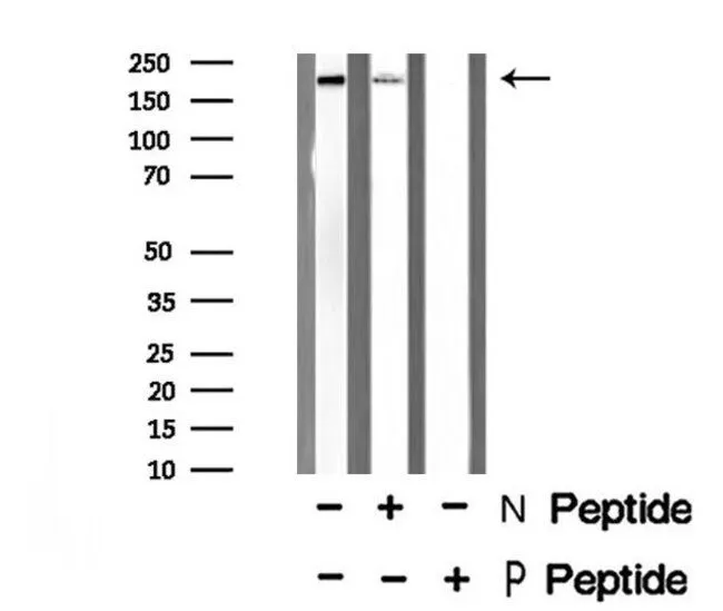 WB analysis of TNF-alpha treated A2780 whole cell lysates using GTX03352 MLCK (phospho Tyr464) antibody. -/+ means absence or presence of N peptide (non-phospho peptide) and P peptide(phospho peptide).