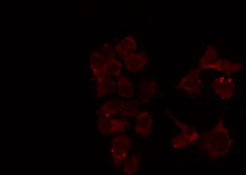 ICC/IF analysis of PFA-fixed HeLa cells using GTX03359 MUTYH antibody. Permeabilization : 0.1% Triton X-100 Dilution : 1:200 ICC/IF analysis of PFA-fixed HeLa cells using GTX03359 MUTYH antibody. Permeabilization : 0.1% Triton X-100 Dilution : 1:200