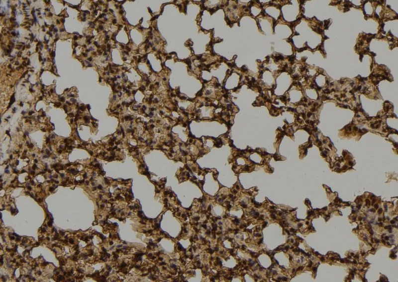 IHC-P analysis of mouse lung tissue section using GTX03359 MUTYH antibody. Antigen retireval : Heat mediated antigen retrieval step in citrate buffer was performed. Dilution : 1:100