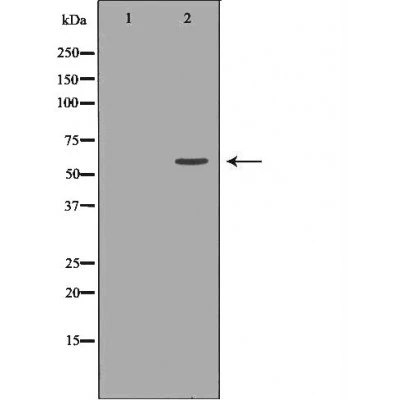 WB analysis of HeLa whole cell lysate using GTX03359 MUTYH antibody. The lane on the left was treated with the antigen-specific peptide.