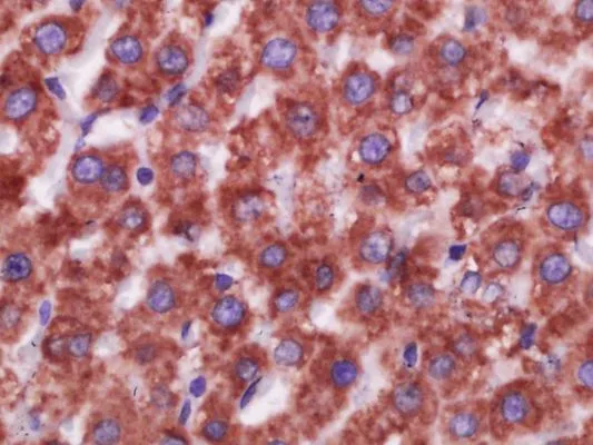 IHC-P analysis of rat liver tissue using GTX03380 CD16a antibody. Antigen retrieval : Boiling in sodium citrate buffer (pH6.0) for 15min. Dilution : 1:400 IHC-P analysis of rat liver tissue using GTX03380 CD16a antibody. Antigen retrieval : Boiling in sodium citrate buffer (pH6.0) for 15min. Dilution : 1:400