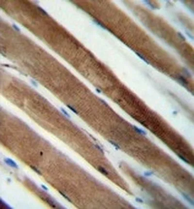 IHC-P analysis of human skeletal muscle using GTX03392 CCDC38 antibody. IHC-P analysis of human skeletal muscle using GTX03392 CCDC38 antibody.