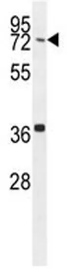 WB analysis of mouse heart tissue lysates (35ug/lane) using GTX03392 CCDC38 antibody.