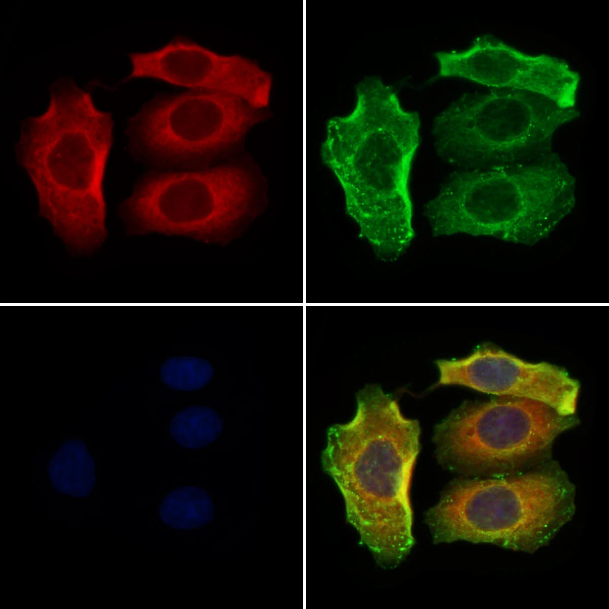 ICC/IF analysis of PFA-fixed HeLa cells using GTX03401 LAT1 / SLC7A5 antibody.<br>Red : Primary antibody<br>Green : beta tubulin<br>Blue : DAPI<br>Permeabilization : 0.1% Triton X-100<br>Dilution : 1:200