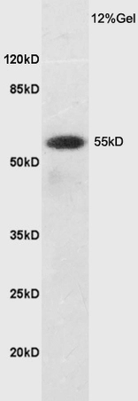 WB analysis of mouse brain tissue lysates using GTX03402 LAT1 / SLC7A5 antibody. Dilution : 1:200 WB analysis of mouse brain tissue lysates using GTX03402 LAT1 / SLC7A5 antibody. Dilution : 1:200