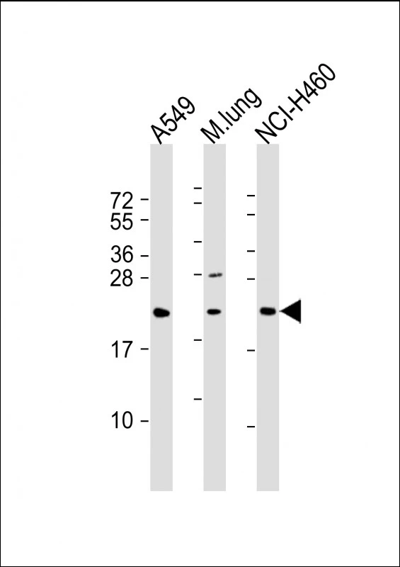 WB analysis of various sample lysates using GTX03411 TUSC1 antibody. Lane 1 : A549 whole cell lysate Lane 2 : mouse lung tissue lysate Lane 3 : NCI-H460 whole cell lysate Dilution : 1:2000 Loading : 20 microg per lane WB analysis of various sample lysates using GTX03411 TUSC1 antibody. Lane 1 : A549 whole cell lysate Lane 2 : mouse lung tissue lysate Lane 3 : NCI-H460 whole cell lysate Dilution : 1:2000 Loading : 20 microg per lane