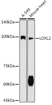 WB analysis of various sample lysates using GTX03428 LOXL2 antibody. Dilution : 1:500 Loading : 25microg per lane WB analysis of various sample lysates using GTX03428 LOXL2 antibody. Dilution : 1:500 Loading : 25microg per lane