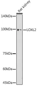 WB analysis of rat kidney tissue lysate using GTX03428 LOXL2 antibody. The signal was developed with ECL plus-Enhanced. Dilution : 1:500 Loading : 25microg per lane