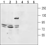 WB analysis of mouse kidney tissue lysates (lanes 1 and 4), rat lung membrane fractions (lanes 2 and 5), and HEK293 cell lysates (lanes 3 and 6) using GTX03430 TPCN2 antibody. Lane 1-3 : Primary antibody Lane 4-6 : Primary antibody preincubated with TPCN2 blocking Peptide Dilution : 1:200