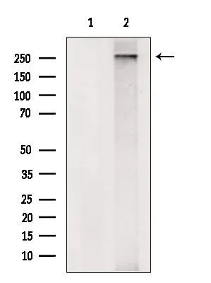 WB analysis of mouse brain tissue lysate using GTX03451 gp340 antibody. The lane on the left was treated with blocking peptide.