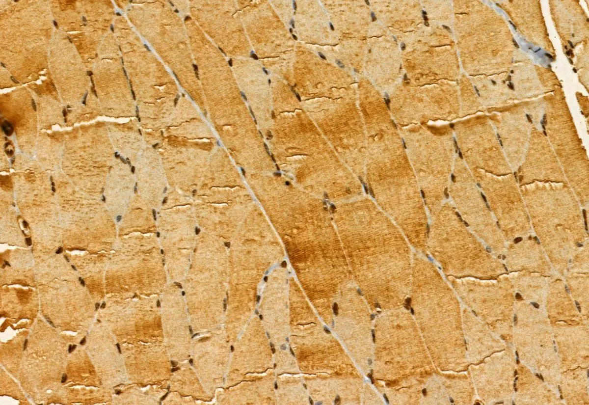 IHC-P analysis of rat muscle tissue using GTX03455 SMCR7 antibody. Antigen retrieval : Heat mediated antigen retrieval step in citrate buffer was performed. Dilution : 1:100
