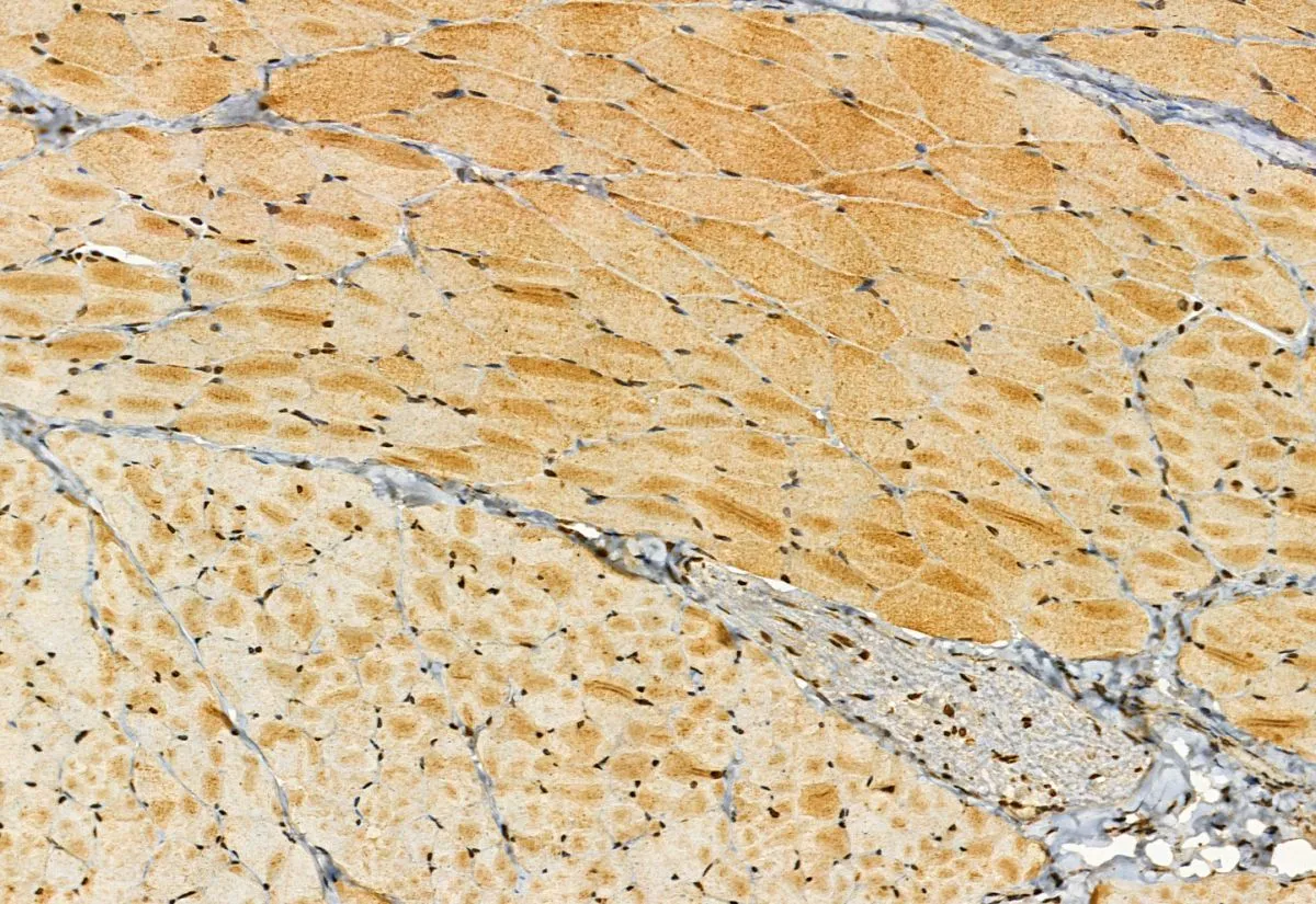 IHC-P analysis of rat skin tissue using GTX03455 SMCR7 antibody. Antigen retrieval : Heat mediated antigen retrieval step in citrate buffer was performed. Dilution : 1:100