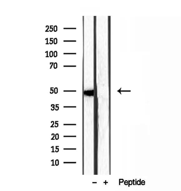WB analysis of HT-1080 whole cell lysate using GTX03455 SMCR7 antibody.