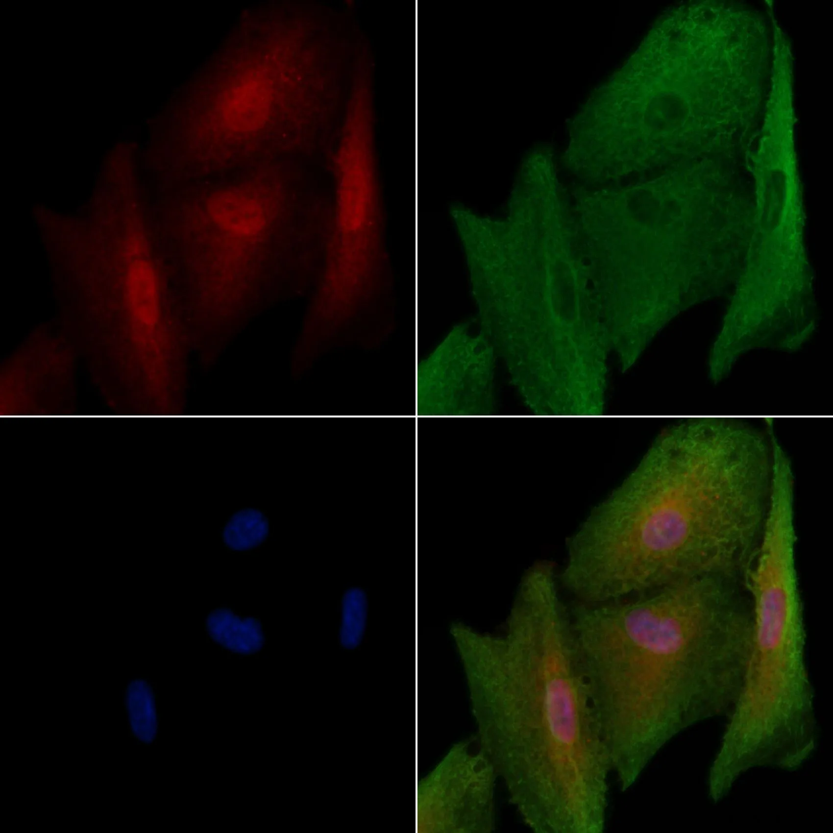 ICC/IF analysis of PFA-fixed A549 cells using GTX03456 MKLP1 antibody. Permeabilization : 0.1% Triton X-100 Red : Primary antibody Green : beta tubulin Blue : DAPI ICC/IF analysis of PFA-fixed A549 cells using GTX03456 MKLP1 antibody. Permeabilization : 0.1% Triton X-100 Red : Primary antibody Green : beta tubulin Blue : DAPI