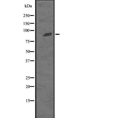 WB analysis of MKLP1 transfected 293T cell lysate using GTX03456 MKLP1 antibody. The lane on the left was treated with the antigen-specific peptide.