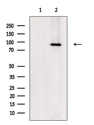 WB analysis of HeLa whole cell lysate using GTX03456 MKLP1 antibody. The lane on the left was treated with blocking peptide.