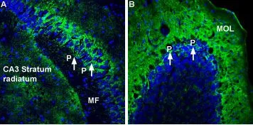 IHC-Fr analysis of mouse hippocampus and cerebellum tissues using GTX03457 Sodium/Potassium ATPase alpha 2 antibody. Panel A : ATP1A2 staining (green, 1:300) in mouse hippocampal CA3 region is labeled in astrocytic processes (arrows surrounding pyramidal cells, P) and diffused staining is observed in the CA3 stratum radiatum. Note absence of staining in the mossy fiber terminal region (MF). Panel B : Staining in mouse cerebellum shows labeling of the basket shape (arrows) under Purkinje cells (P) and diffused staining in the molecular layer (MOL). IHC-Fr analysis of mouse hippocampus and cerebellum tissues using GTX03457 Sodium/Potassium ATPase alpha 2 antibody. Panel A : ATP1A2 staining (green, 1:300) in mouse hippocampal CA3 region is labeled in astrocytic processes (arrows surrounding pyramidal cells, P) and diffused staining is observed in the CA3 stratum radiatum. Note absence of staining in the mossy fiber terminal region (MF). Panel B : Staining in mouse cerebellum shows labeling of the basket shape (arrows) under Purkinje cells (P) and diffused staining in the molecular layer (MOL).