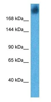 WB analysis of human stomach tissue lysate using GTX03459 gp340 antibody. Dilution : 1microg/ml