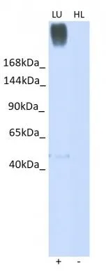 WB analysis of various sample lysates using GTX03459 gp340 antibody. Dilution : 1microg/ml Positive control (+) : human lung (LU) Negative control (-) : HeLa lysate (HL)