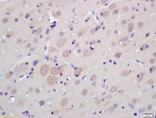 IHC-P analysis of rat brain tissue using GTX03460 MOBP antibody. Dilution : 1:200 IHC-P analysis of rat brain tissue using GTX03460 MOBP antibody. Dilution : 1:200