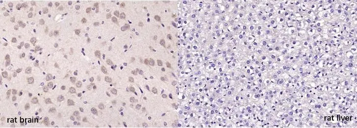 IHC-P analysis of rat brian (left) and rat liver (right) tissue using GTX03460 MOBP antibody. Antigen retrieval : Boiling in sodium citrate buffer (pH6.0) for 15min Dilution : 1:200