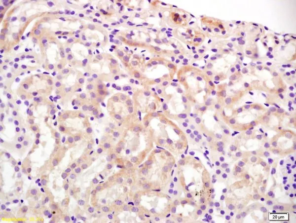 IHC-P analysis of mouse kidney tissue using GTX03462 Slco1a1 antibody. Dilution : 1:200 IHC-P analysis of mouse kidney tissue using GTX03462 Slco1a1 antibody. Dilution : 1:200