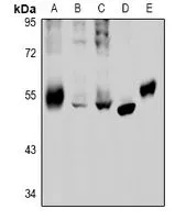 WB analysis of vaious sample lysates using GTX03471 GABA A Receptor beta 2 antibody. Lane A : C6 whole cell lysate Lane B : U87MG whole cell lysate Lane C : HEK293T whole cell lysate Lane D : HCC827 whole cell lysate Lane E : rat lung tissue lysate