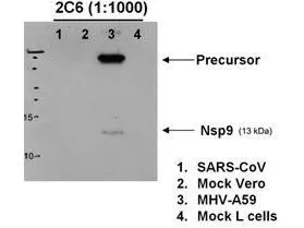 WB analysis of various sample lysates using GTX03482 Hepatitis virus A59 nsp9 antibody [2C6.H1]. Lane 1 : SARS-CoV-infected Vero cells Lane 2: Vero cells (mock) Lane 3 : MHV-A59-infected mouse L cells Lane 4 : mouse L cells (mock)