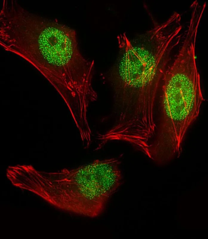 ICC/IF analysis of 4% PFA-fixed HeLa cells using GTX03495 MyoD1 antibody. Green : Primary antibody Red : Actin Permeabilization : 0.1% Triton X-100 Dilution : 1:25 ICC/IF analysis of 4% PFA-fixed HeLa cells using GTX03495 MyoD1 antibody. Green : Primary antibody Red : Actin Permeabilization : 0.1% Triton X-100 Dilution : 1:25