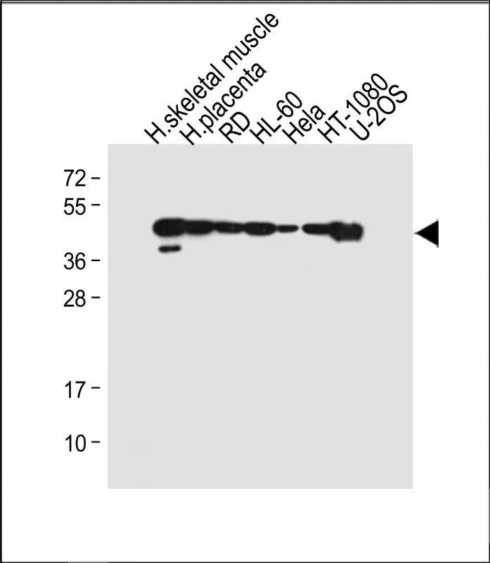 WB analysis of various sample lysates using GTX03495 MyoD1 antibody. Lane 1 : Human skeletal muscle tissue lysate Lane 2 : Human placenta tissue lysate Lane 3 : RD whole cell lysate Lane 4 : HL-60 whole cell lysate Lane 5 : HeLa whole cell lysate Lane 6 : HT-1080 whole cell lysate Lane 7 : U-2OS whole cell lysate Dilution : 1:4000 Loading : 20 microg per lane