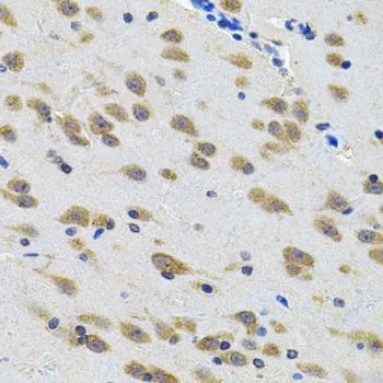 IHC-P analysis of rat brain tissue using GTX03496 LGR6 antibody. Dilution : 1:100